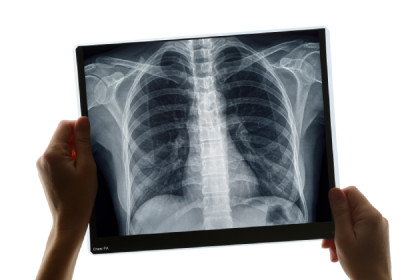 x_ray